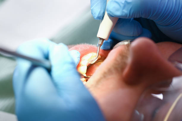 Best Emergency Broken Tooth Repair in Alturas, CA