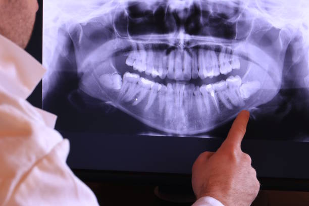 Best Emergency Treatment for Toothache in Alturas, CA